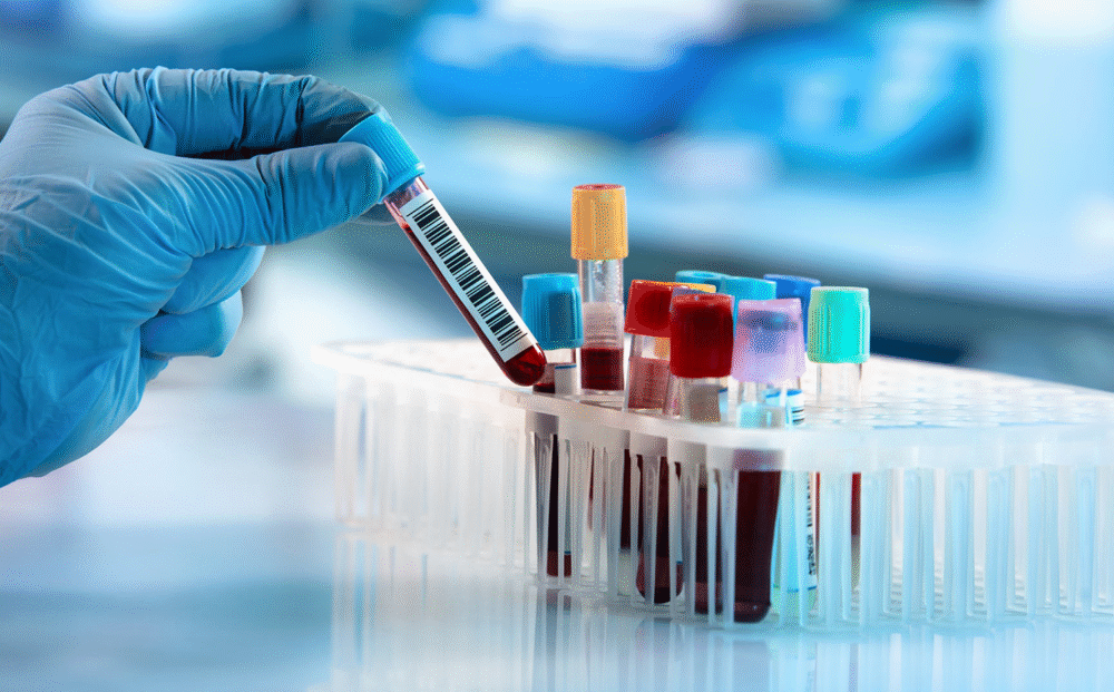 Lab & Home Sample Collection